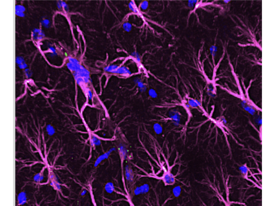 Advancing Neuroscience